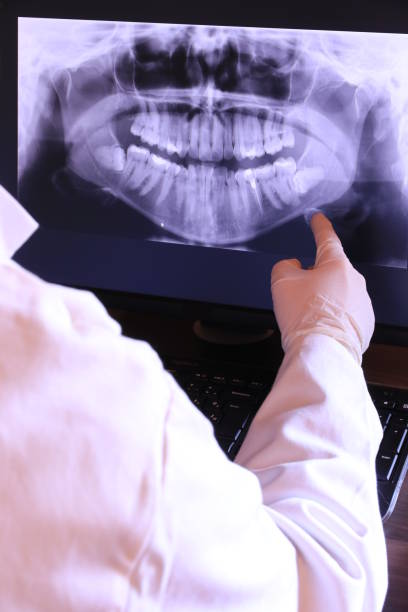 Best Emergency Broken Tooth Repair in Noank, CT